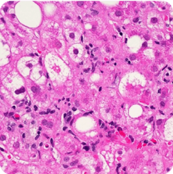 Tissue sample